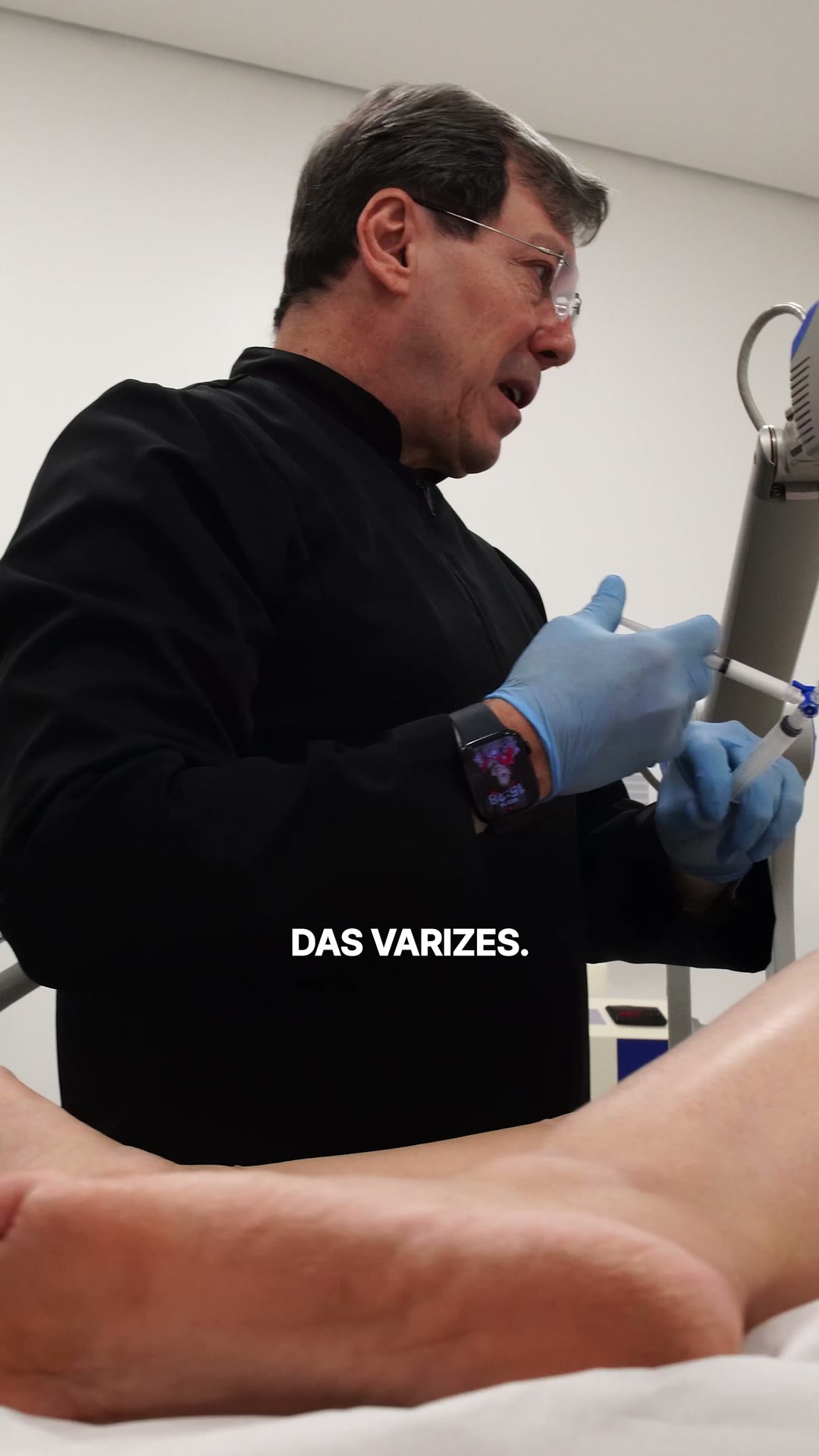 Vídeo: como é o tratamento de varizes no consultório